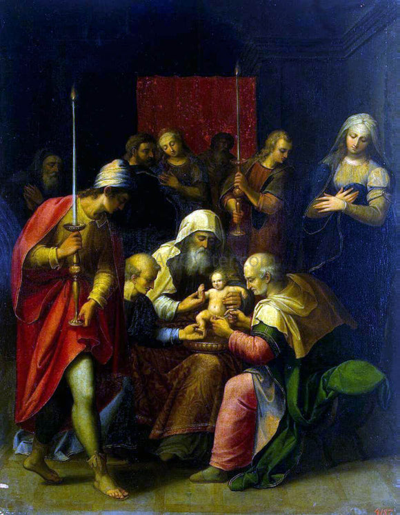  Luis De Carbajal Circumcision - Canvas Art Print